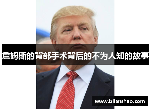 詹姆斯的背部手术背后的不为人知的故事